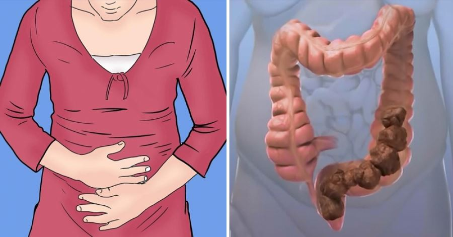 Діагностика закрепів: чому важливо звернутися до лікаря