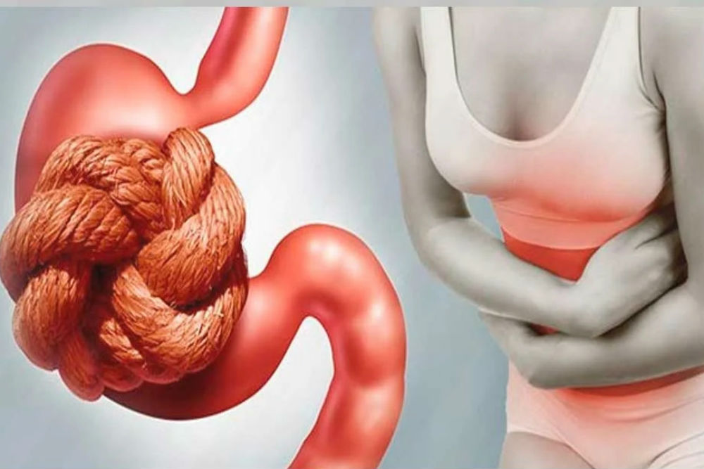 Що таке закреп?