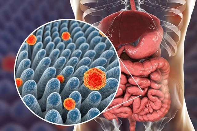 Причини розвитку патології