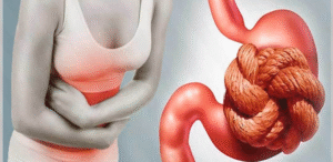 Контактні проносні засоби проти «народних методів»: що ефективніше і безпечніше