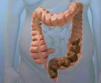 Класифікація закрепів