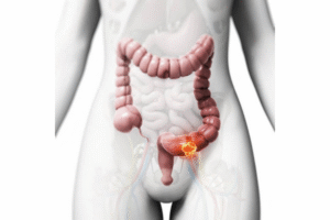 Контактные слабительные в эпоху пробиотиков и пребиотиков: актуальны ли они до сих пор