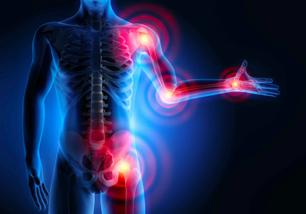 Симптоми постковідного суглобового синдрому